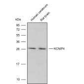 Solarbio K009848P Anti-KCNIP4 Polyclonal Antibody