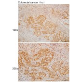 Solarbio K110024P Anti-ACOT7 Polyclonal Antibody