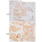 Solarbio K110465P Anti-CD46 Polyclonal Antibody