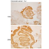 Solarbio K110486P Anti-ODF2 Polyclonal Antibody