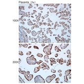 Solarbio K112412P Anti-ARHGDIG Polyclonal Antibody