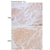 Solarbio K110059P Anti-NBPF1 Polyclonal Antibody