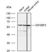 Solarbio K110050P Anti-IGF2BP2 Polyclonal Antibody