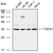 Solarbio K110017P Anti-TADA1 Polyclonal Antibody