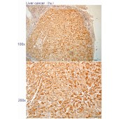 Solarbio K112275P Anti-CPNE2 Polyclonal Antibody