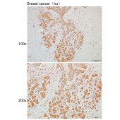 Solarbio K110305P Anti-ABHD12B Polyclonal Antibody