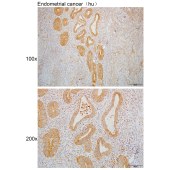 Solarbio K110106P Anti-DYRK2 Polyclonal Antibody