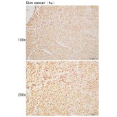 Solarbio K110514P Anti-H2AC6 Polyclonal Antibody