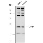 Solarbio K109932P Anti-COQ7 Polyclonal Antibody
