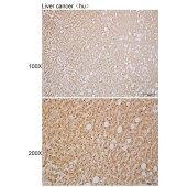 Solarbio K110091P Anti-FXYD5 Polyclonal Antibody