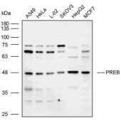 Solarbio K109996P Anti-PREB Polyclonal Antibody