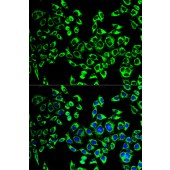 Solarbio K001776P Anti-HSPD1 Polyclonal Antibody