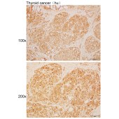 Solarbio K110402P Anti-PIWIL4 Polyclonal Antibody