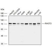 Solarbio K110066P Anti-RHOT2 Polyclonal Antibody
