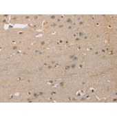Solarbio K009898P Anti-ZBTB26 Polyclonal Antibody
