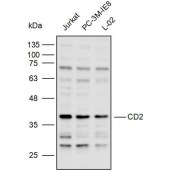 Solarbio K110065P Anti-CD2 Polyclonal Antibody