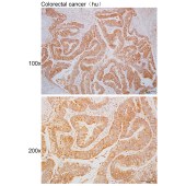 Solarbio K110387P Anti-SAMD4A Polyclonal Antibody