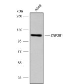 Solarbio K009819P Anti-ZNF281 Polyclonal Antibody