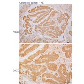 Solarbio K110344P Anti-NR0B1 Polyclonal Antibody