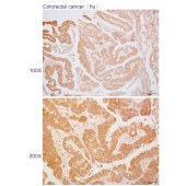 Solarbio K110407P Anti-ZC3H14 Polyclonal Antibody