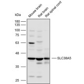 Solarbio K110476P Anti-SLC38A5 Polyclonal Antibody