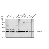 Solarbio K112289P Anti-GOSR2 Polyclonal Antibody