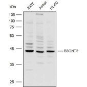 Solarbio K110361P Anti-B3GNT2 Polyclonal Antibody