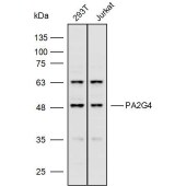 Solarbio K110010P Anti-PA2G4 Polyclonal Antibody