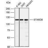 Solarbio K110118P Anti-STARD8 Polyclonal Antibody