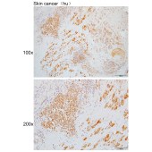Solarbio K110120P Anti-ARL11 Polyclonal Antibody