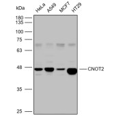 Solarbio K110459P Anti-CNOT2 Polyclonal Antibody