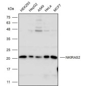 Solarbio K110398P Anti-NKIRAS2 Polyclonal Antibody