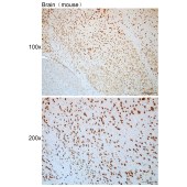 Solarbio K112423P Anti-SCGB1A1 Polyclonal Antibody