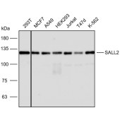 Solarbio K112428P Anti-SALL2 Polyclonal Antibody