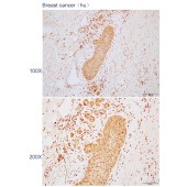 Solarbio K110468P Anti-MUC1 Polyclonal Antibody