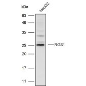 Solarbio K110524P Anti-RGS1 Polyclonal Antibody