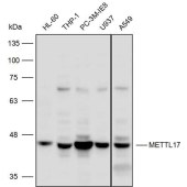 Solarbio K110373P Anti-METTL17 Polyclonal Antibody