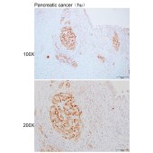 Solarbio K110349P Anti-NAPRT Polyclonal Antibody