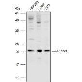 Solarbio K110497P Anti-RPP21 Polyclonal Antibody