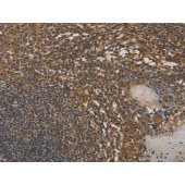 Solarbio K009798P Anti-DAB2 Polyclonal Antibody