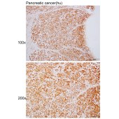 Solarbio K110357P Anti-UPRT Polyclonal Antibody