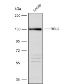 Solarbio K009881P Anti-RBL2 Polyclonal Antibody
