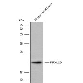 Solarbio K009824P Anti-PRXL2B Polyclonal Antibody