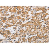 Solarbio K009905P Anti-ARHGAP15 Polyclonal Antibody