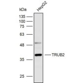 Solarbio K110029P Anti-TRUB2 Polyclonal Antibody