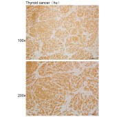 Solarbio K110055P Anti-UAP1 Polyclonal Antibody