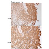 Solarbio K112160P Anti-MINK1 Polyclonal Antibody