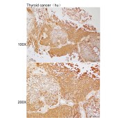 Solarbio K112201P Anti-MYOM2 Polyclonal Antibody