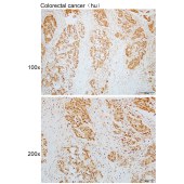Solarbio K110125P Anti-IFT81 Polyclonal Antibody