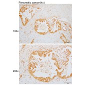 Solarbio K110008P Anti-CCDC112 Polyclonal Antibody